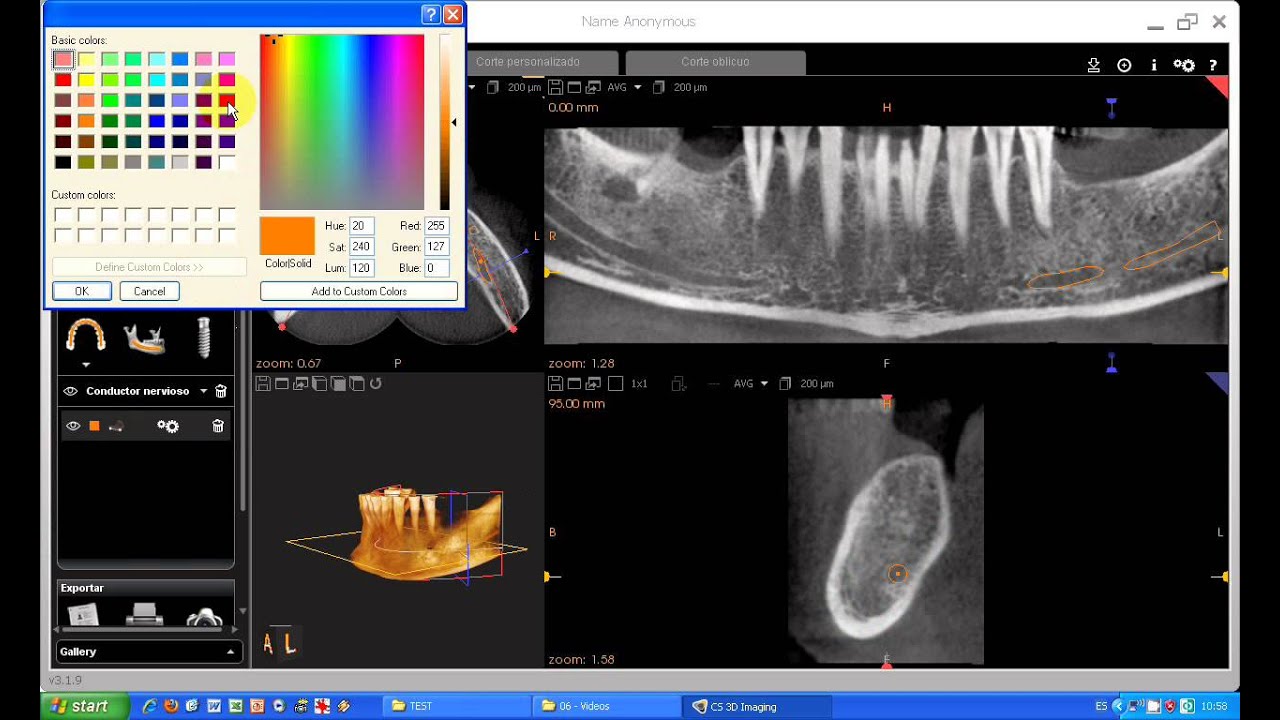 carestream imaging software installation